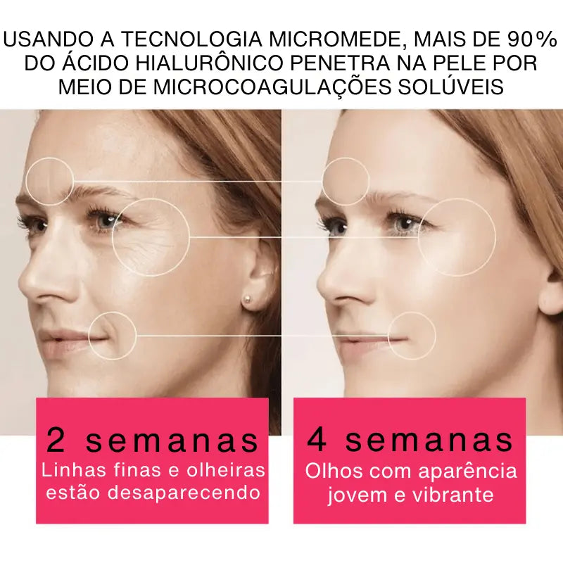 Adesivos de Microagulhas Rejuvenescedores