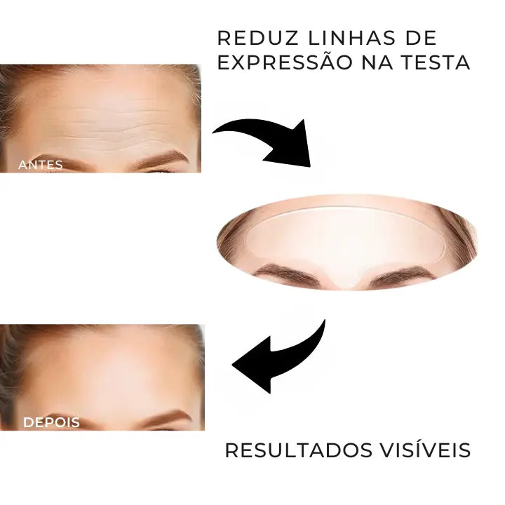 Adesivos Antirrugas Primelift™ o melhor adesivo suavizante de rugas do mundo - Comprovado!